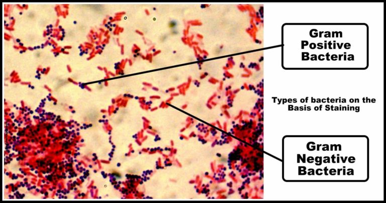 Types of Bacteria on basis of Shape, Nutrition & Respiration - Study Wrap